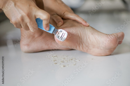 Pedicure remove dead skin on feet, women's foot care