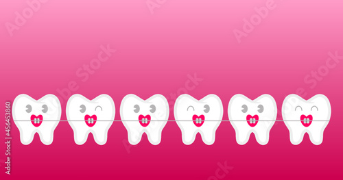 Pink Heart Braces on Teeth