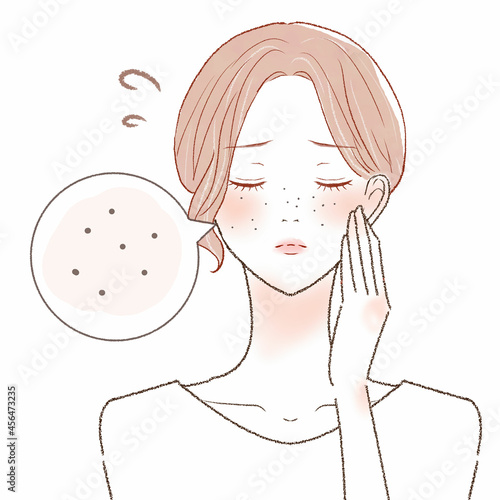黒ずみ毛穴に悩む女性