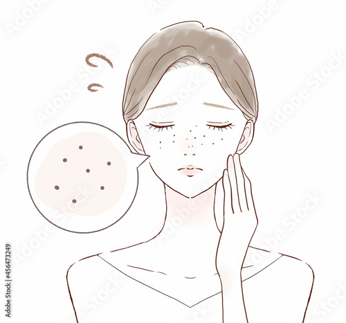 黒ずみ毛穴に悩む女性