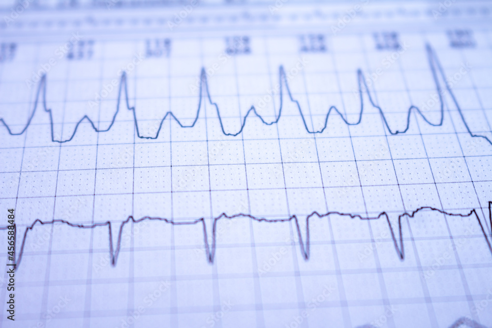 Heartbeats represented on graph paper. Electrocardiogram with selective focus. Heartbeats represented on graph paper. Electrocardiogram with selective focus.