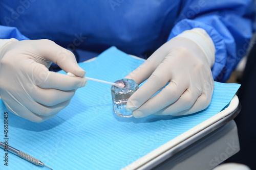 Foto application of fluoride gel in dental patients