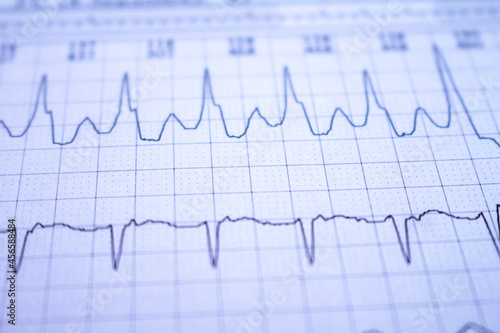 Heartbeats represented on graph paper. Electrocardiogram with selective focus.