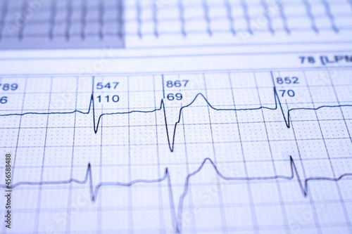 Heartbeats represented on graph paper. Electrocardiogram with selective focus.