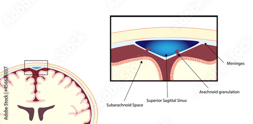 Superior Sagittal Sinus coronal section anatomy   photo