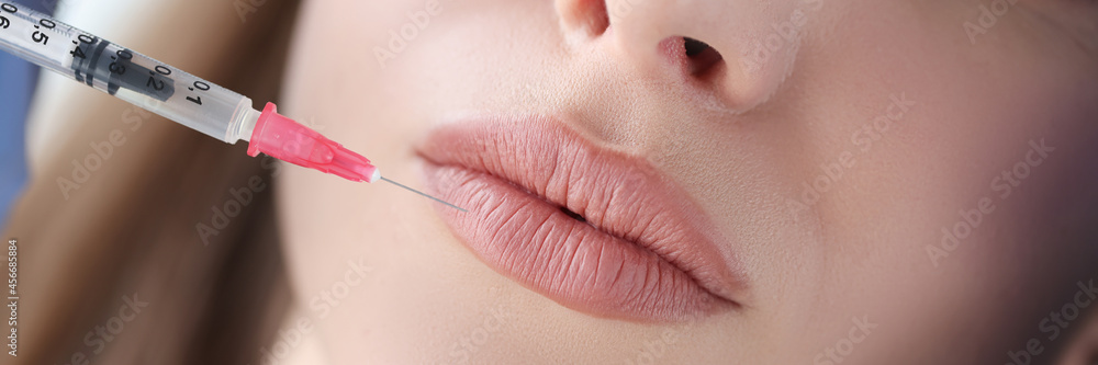 Portrait of woman whose lips are injected by beautician Portrait of woman whose lips are injected by beautician