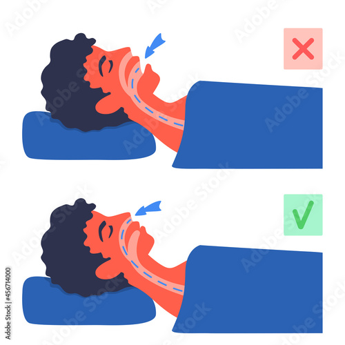 Breathing in asleep. A man laying on his back with an open, closed mouth. Incorrect and correct airflow. Air going through nose and mouth. Snoring, sleep apnea problem. A vector cartoon illustration.