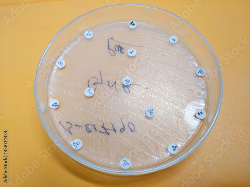 Antimicrobial susceptibility testing in petri dish, Susceptibility of Enterobacter bacteria, All the commonly used antibiotic are resistance except Amikacin. photo