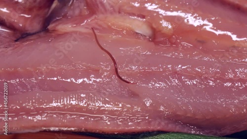 魚に寄生するシュードテラノーバ　	アニサキス症のイメージ素材 photo