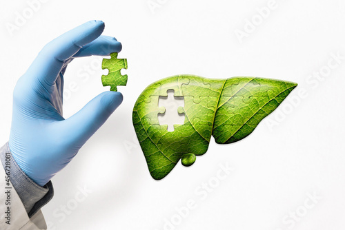 Puzzle with illustration of green liver and doctor's hand with the missing piece of puzzle. Liver treatment concept.
