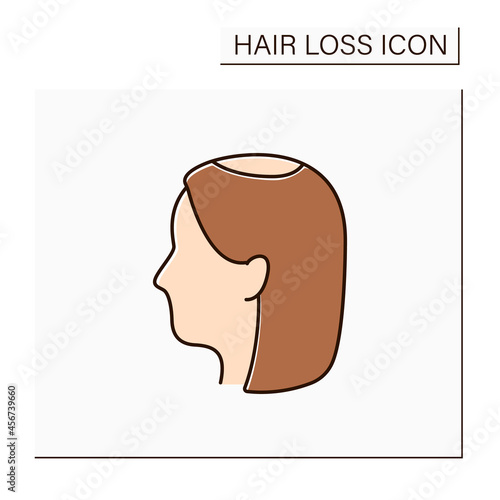 Hair loss color icon. Woman loses hair.Early hair thinning in vertex. Alopecia concept. Isolated vector illustration