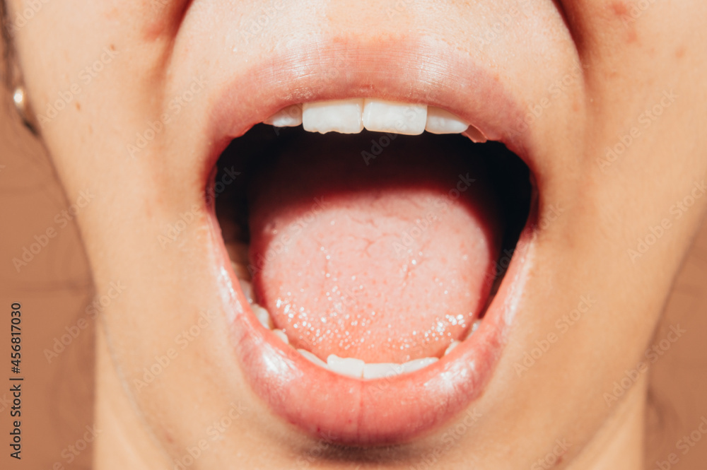 Obraz premium Latin woman denture for endodontics and dentistry different views