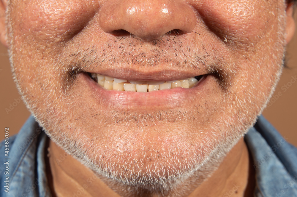 Obraz premium Latino adult man in dental positions for smile study