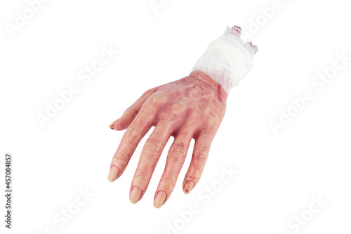 Realistic artificial rubber severed dead human hand with bandage, isolated on white background photo