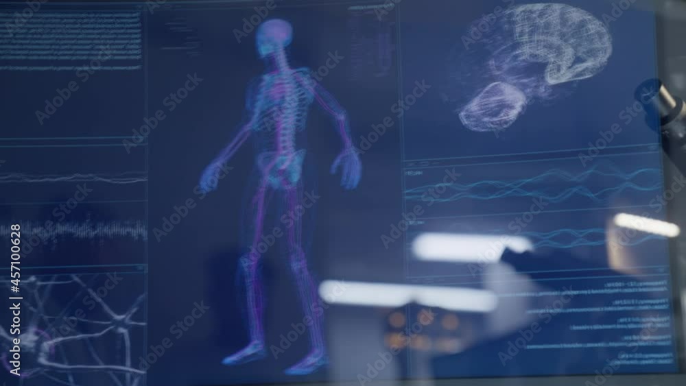 Human skeleton models on computer screen. Looking for injury ...