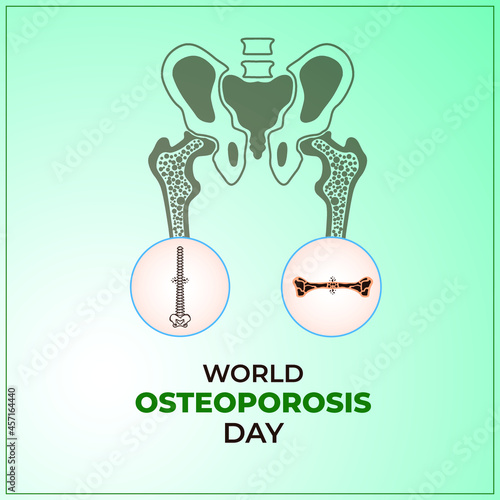 World Osteoporosis Day concept. October 20. Template for background, banner, card, poster. Vector illustration.