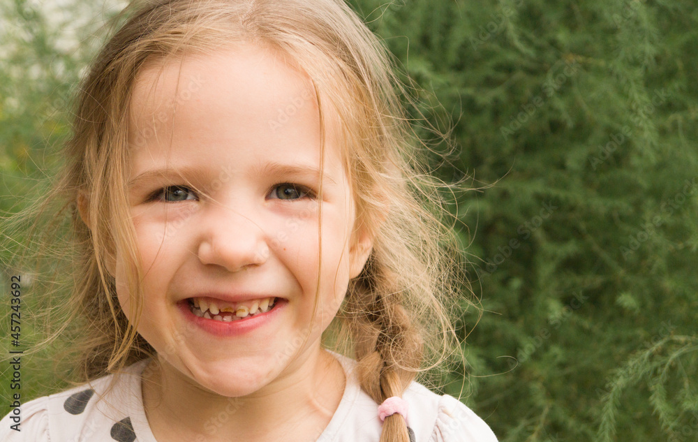 A little Caucasian girl laughs sincerely, a smile with a broken tooth. A little Caucasian girl laughs sincerely, a smile with a broken tooth.
