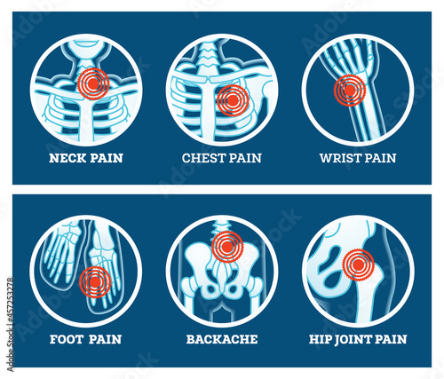 Body Pain. Icons Set. Pain in Neck, Chest, Foot, Backache, Hip Joint and Wrist. photo