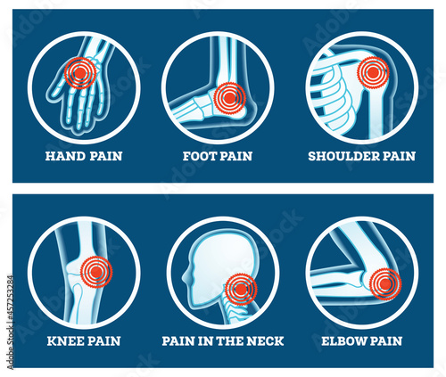 Body Pain. Icons Set. Pain in Hand, Knee, Neck, Elbow, Foot and Shoulder.