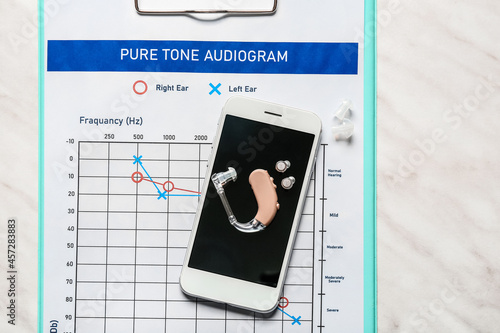 Mobile phone with hearing aid and audiogram on white background photo