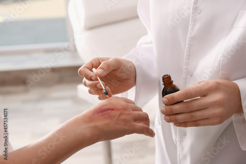 Doctor applying brilliant green onto injured hand indoors, closeup photo