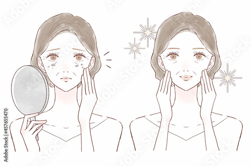 シミを気にする中年女性のビフォーアフター