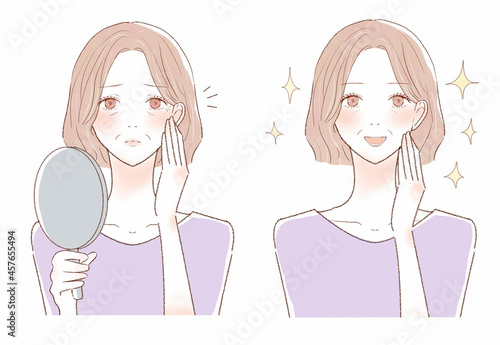皺を気にする中年女性のビフォーアフター