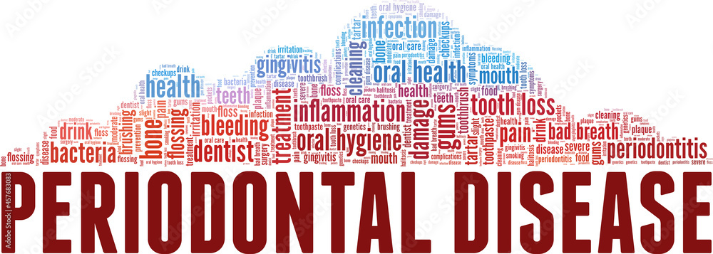 Fototapeta premium Periodontitis - Periodontal Disease vector illustration word cloud isolated on white background.