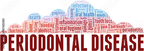 Periodontitis - Periodontal Disease vector illustration word cloud isolated on white background.