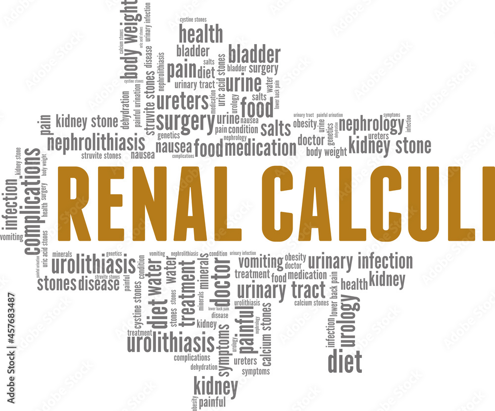 Fototapeta premium Renal Calculi vector illustration word cloud isolated on a white background.