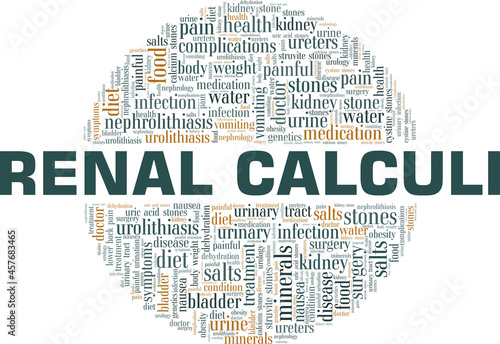 Renal Calculi vector illustration word cloud isolated on a white background.