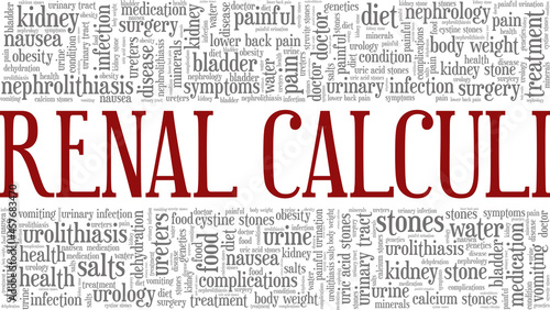 Renal Calculi vector illustration word cloud isolated on a white background.