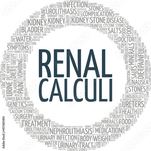 Renal Calculi vector illustration word cloud isolated on a white background.