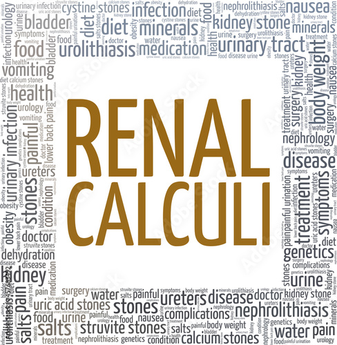 Renal Calculi vector illustration word cloud isolated on a white background.