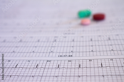 Electrocardiogram of a cardiac patient. Heartbeat written on paper. Selective focus. photo