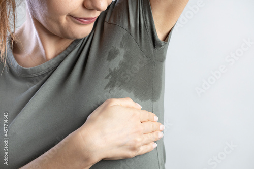 Young woman with hyperhidrosis sweating. Young woman with sweat stain on her clothes.. photo