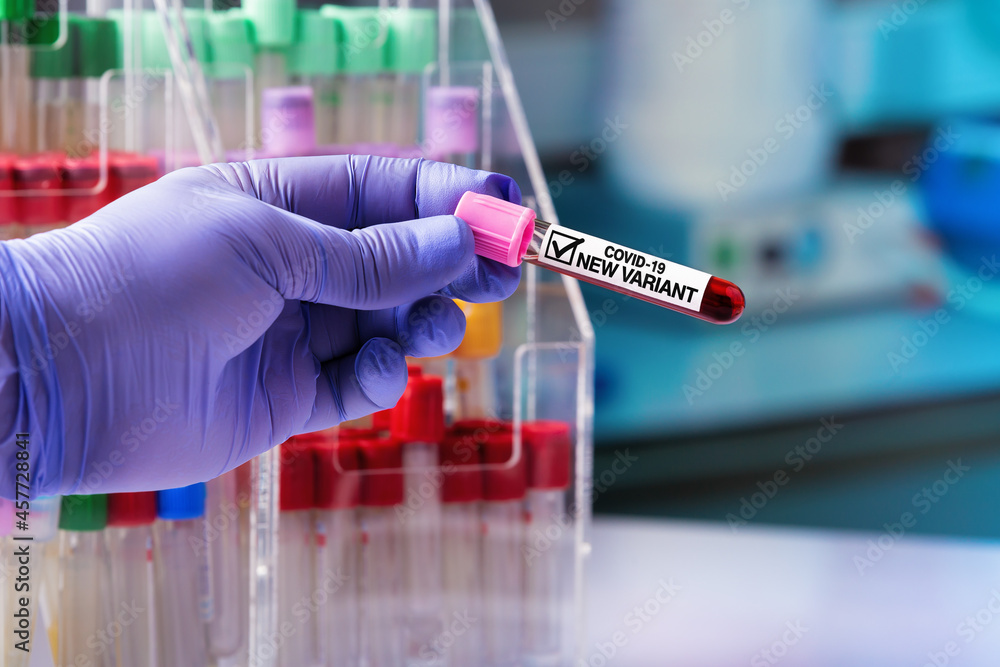 Virologist with a tube of blood with a positive result for a new variant of Coronavirus Covid-19. Epidemiologist working with a blood sample labeled with Covid-19 New Variant Virologist with a tube of blood with a positive result for a new variant of Coronavirus Covid-19. Epidemiologist working with a blood sample labeled with Covid-19 New Variant
