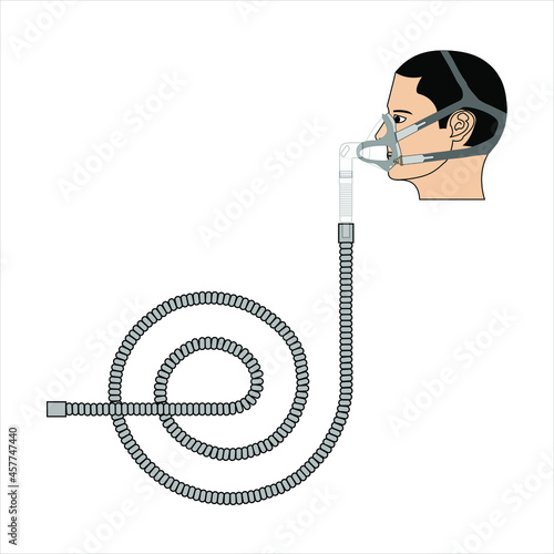 Paciente con mascara arnes y manguera vista lateral Paciente con mascara para equipo CPAP