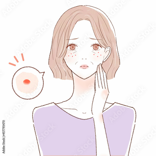 ニキビを気にする中年女性