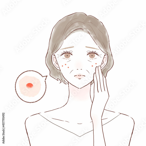 ニキビを気にする中年女性