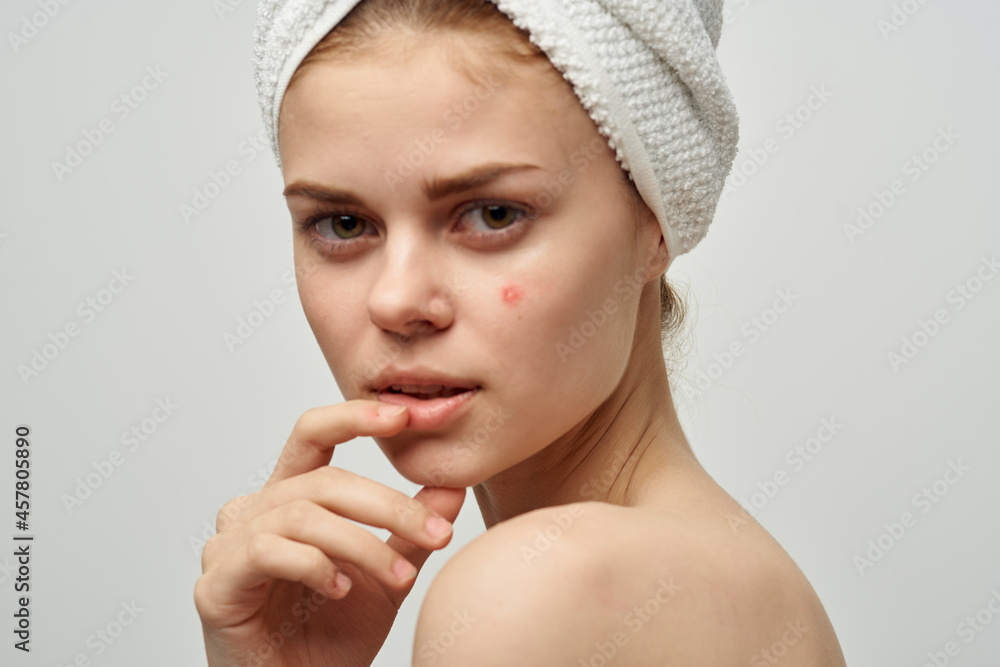 pretty woman with a pimple on the face cosmetology Studio