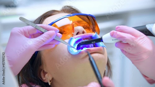 Dentist Prepares Patient For Teeth Whitening Procedure Woman Patient In Dental Clinic. Slow Motion Effect. Close Up