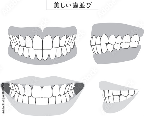 美しい歯並び　セットイラスト