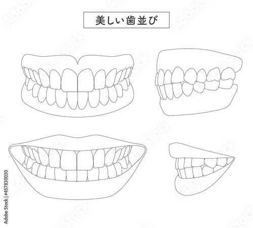 美しい歯並び　セットイラスト