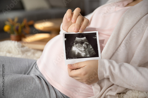 First photo of beloved baby. Close up of happy young woman expecting child hold sonogram image of future newborn close to pregnant tummy. Prenatal diagnostics pregnancy reproductive healthcare concept photo