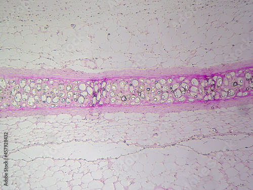 Histology image showing hyaline cartilage, perichondrium, and surround adipose tissue (100x) photo