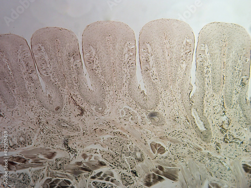 Histology image of papillae of tongue showing taste buds (100x)