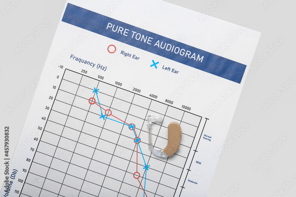 Audiogram with hearing aid on light background Audiogram with hearing aid on light background