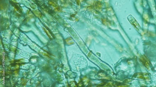 The natural habitat of unicellular organisms, bacteria, algae. A drop of fresh water under a microscope photo