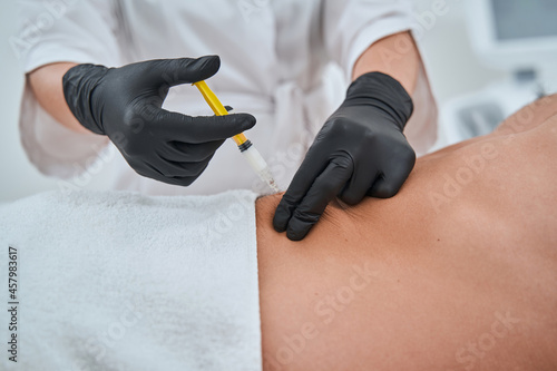 Dermatologist performing a non-invasive fat reduction procedure photo